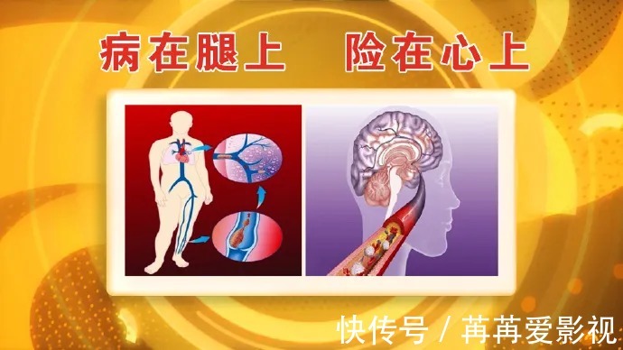 养生堂|身体3个地方疼，可能是血管堵了！老中医调养食疗方，你家也有