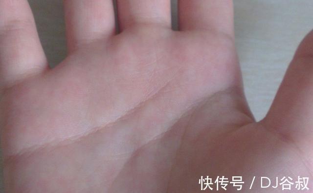 绿茶|你清楚“糖尿病”吗?如何降“血糖”?建议:常吃以下这5种食物