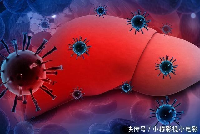 人体|43岁女子,从肝硬化到肝功正常,医生:常吃1物,肝脏慢慢柔软