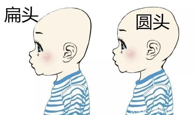 小碰|“妈妈别给我睡扁头”，为何老一辈坚持给娃睡扁头，真的很毁颜值！