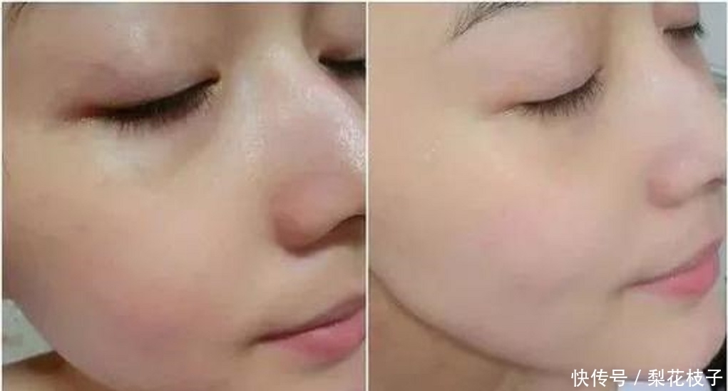 “祛斑高手”生姜加它敷脸,7天美白淡斑,比去美容院还要好