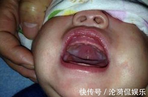 马牙|宝宝出生一个月后意外得了败血症,妈妈后悔当初为什么要听婆婆话