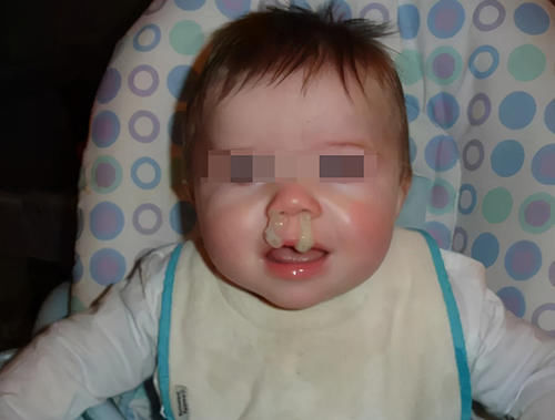 宝宝流鼻涕就是感冒了？未必，从鼻涕颜色中判断是否是“真感冒”