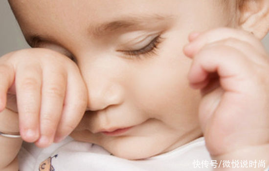 黑眼圈很严重怎么办？怎么拯救特别严重的黑眼圈？