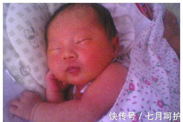 黄疸|孕期最好少吃这三种食物,它们是新生儿黄疸的温床,对孕妇也不利