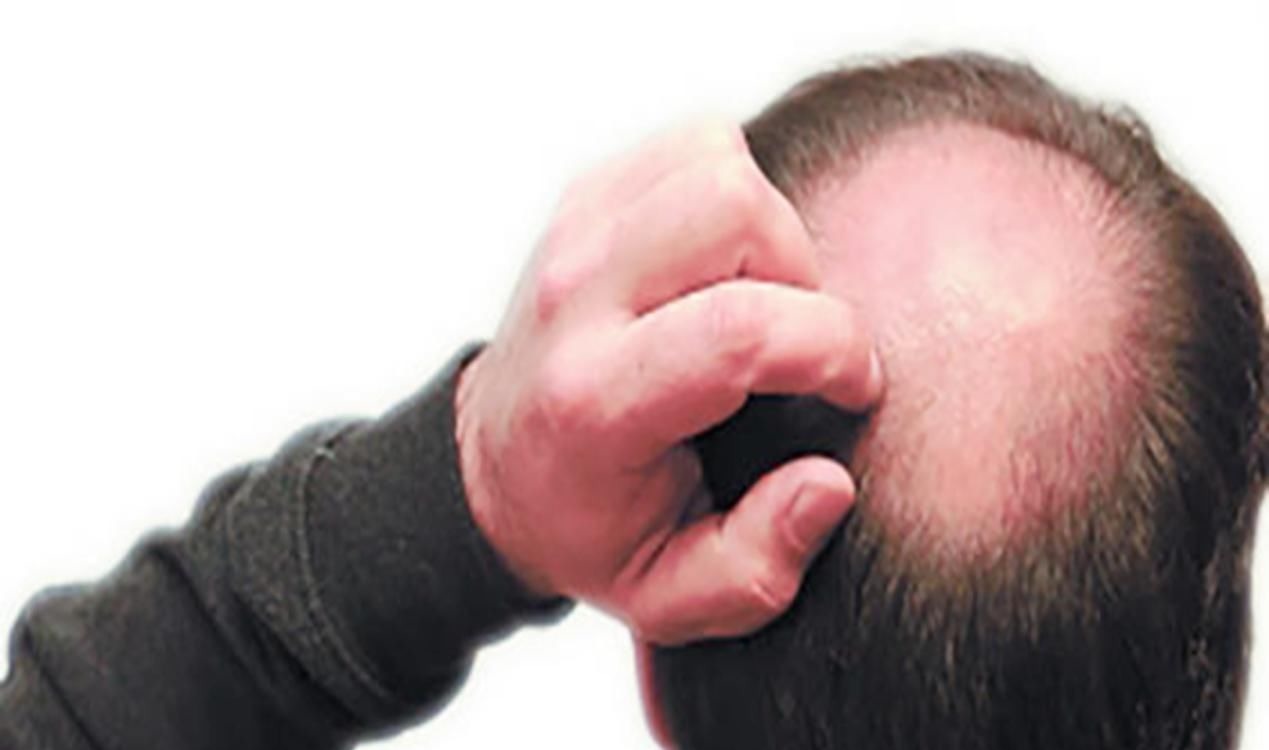 大眼睛|爸爸这些“毁形象”特征,基本“传男不传女”,第一个就很难接受!