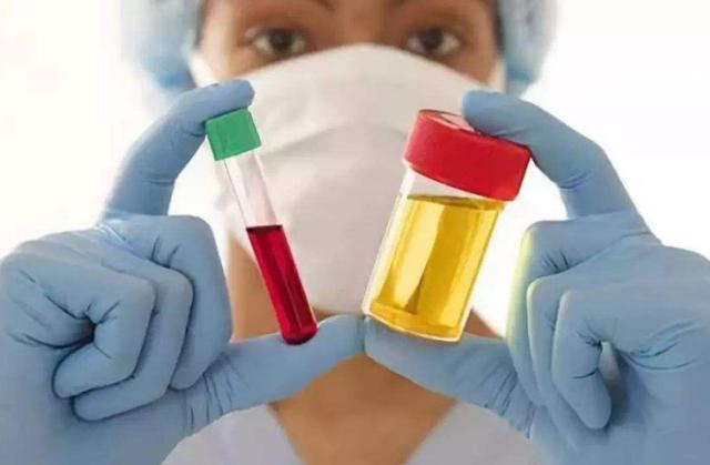 茜草科|枸杞能降尿酸医生这是不可能的，降尿酸最管用的食物是这个