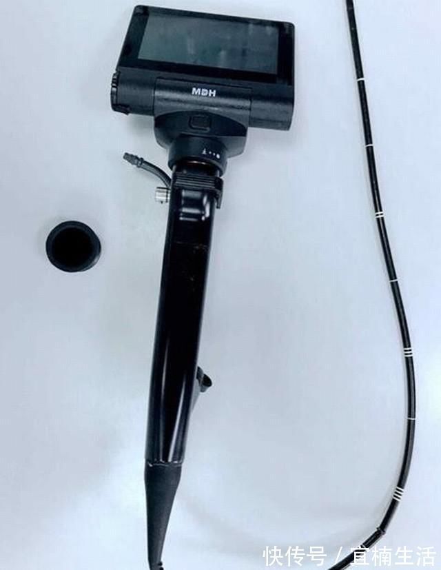 气管插管|真·如鲠在喉!济一2个月小孩嗓子里长了巨大肿瘤