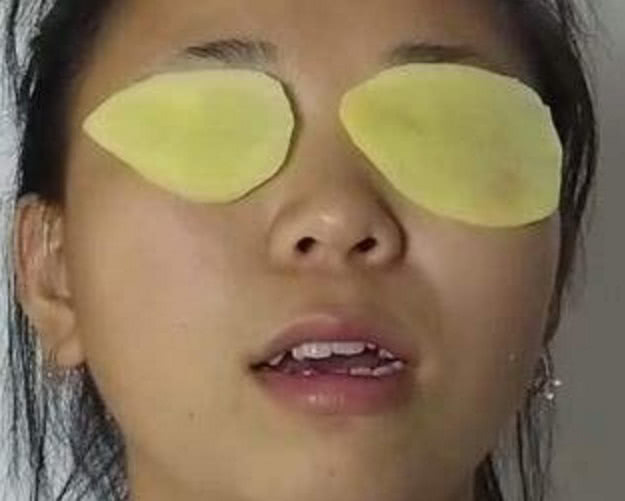 水垢|切2片土豆贴在眼睛上,原来作用这么大,你也快来试试吧