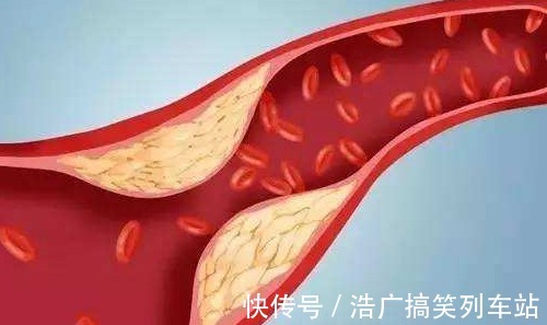 膳食纤维|建议中老年,若不缺钱多吃这2物,稳血脂通血管,还不贵