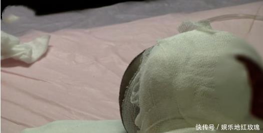 烧伤科|5人不同程度烧伤，2岁幼儿瞬间变火团！罪魁祸首竟是一只大鹅