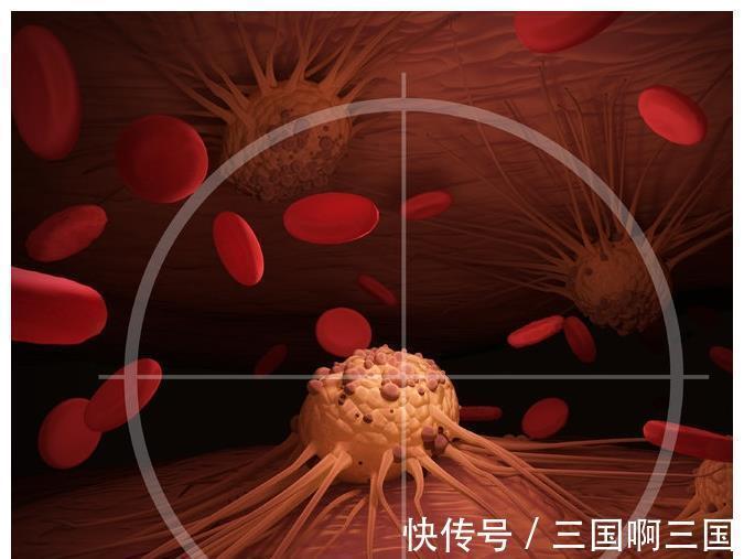 癌症患者|肿瘤专家揭秘:癌症患者永远不明白的4个真相