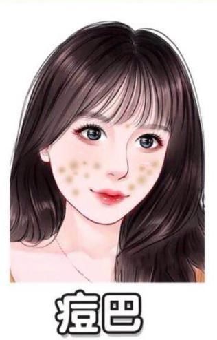 掌握6种痘印去除指南,不要“月球脸”,轻松养成“牛奶肌”