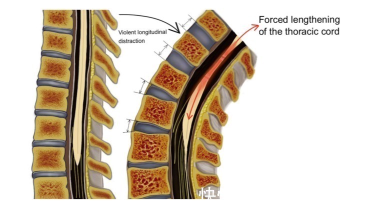胸髓|医生的孩子,为啥都不去学舞蹈?这可能是孩子圈的潜规则
