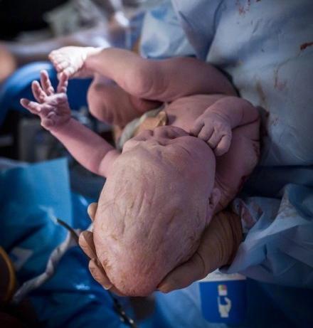 宝爸|医院“黑脸宝宝”火了,宝妈耐心等待娃长大,长开后人人夸