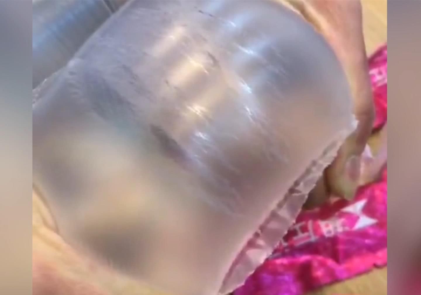 孕妇|妊娠纹是怎么产生的?网友用塑料袋像大家展示,简直不要太形象