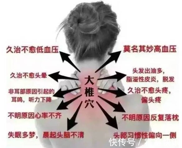 厨房|“十个颈椎九个包”，厨房中拿瓶醋，此法能治好，早知早受益