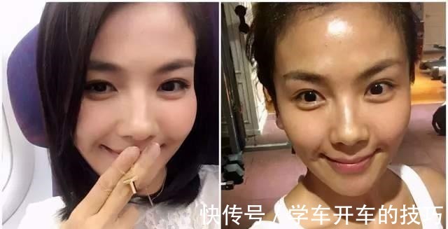 皮脂腺 油性肌肤如何护肤冬天就不需要保养护肤吗!