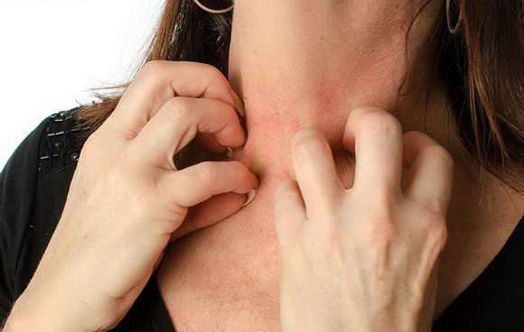 hiv|全国“艾滋”患者125万，不论男女，脖颈处若有这“标志”要注重