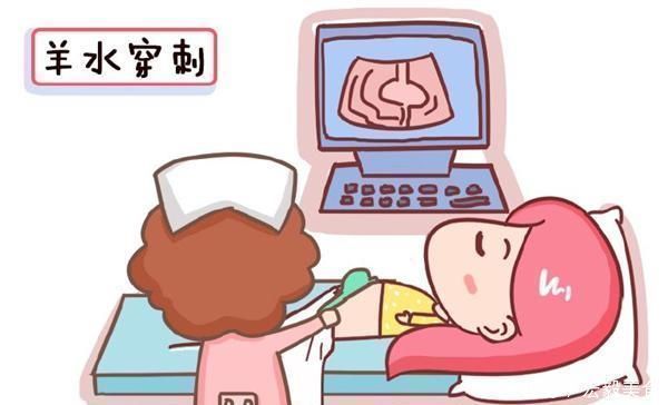 孕妈|孕期5大“排畸”检查,其中3项每个孕妈都要做,快看你落下了哪个