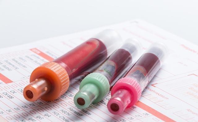 高血脂|三七粉能降压、降糖吗,哪些人不适合喝三七粉,早看早知早受益