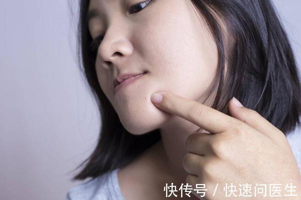 彩妆 脸上长了痘痘?不用着急,分享4招,帮助脸庞恢复白净