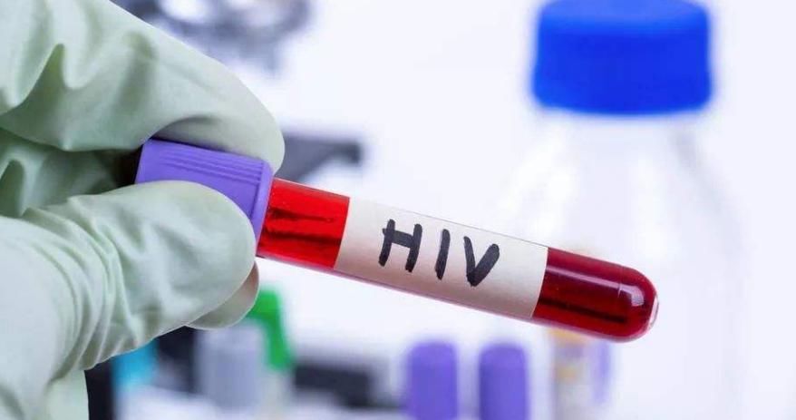  艾滋病|艾滋病感染后，口腔中可能有2种“变化”，但很多人对此视而不见