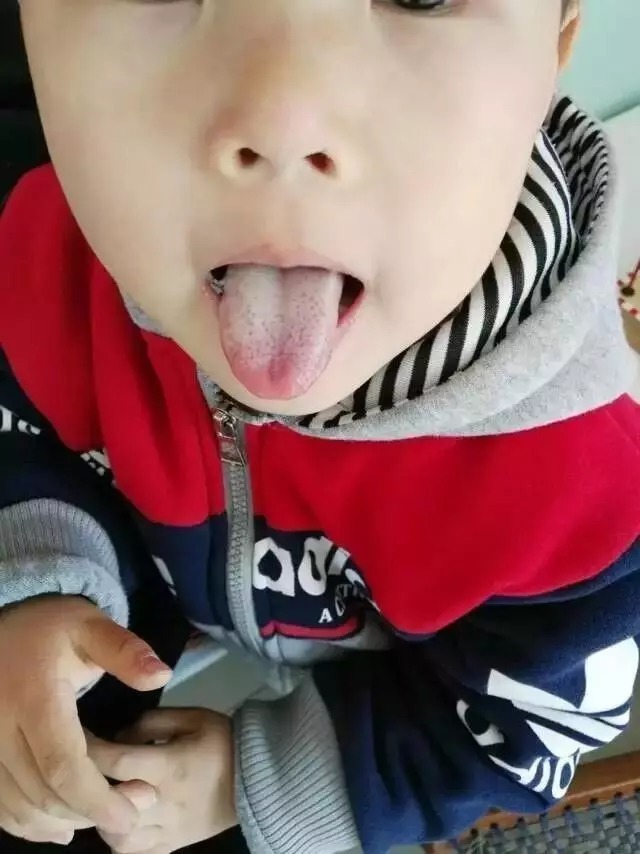 管它什么咳嗽鼻涕,只需一碗汤,睡一觉除根!