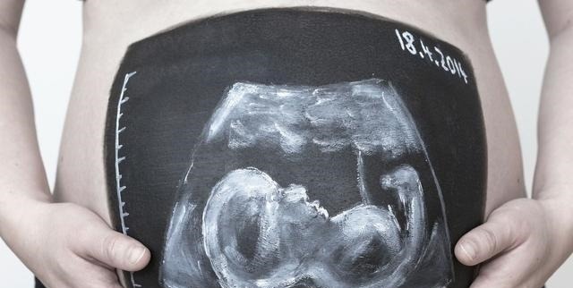 睡眠时间|做四维时宝宝趴着不愿意动,原来是这些原因,做好这点一次通过