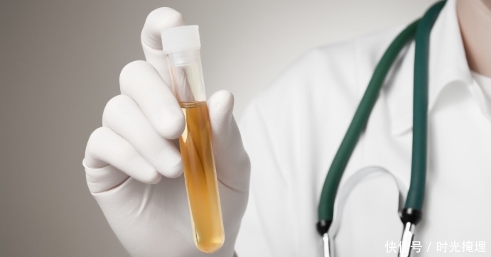 尿蛋白1十怎么调理?医生:现在明白也不迟