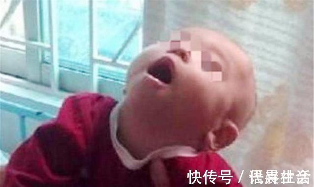 阿杰|宝宝抬头太早不是好事,父母别当发育快沾沾自喜,可能是异常信号