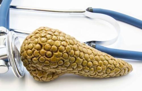 胆结石|“胰腺癌”容易发生在这6类人身上，若出现这3个特征，需警惕