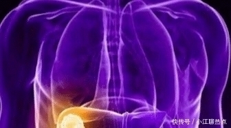 食物|为什么全球肝癌一半都在中国这3种食物太伤肝,别再吃了