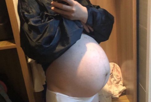 清晰度|现实的四维彩超,不是爬楼梯,就是胎儿不配合