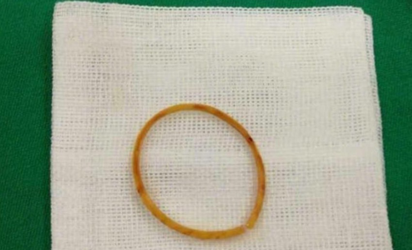 手臂疼|三岁女孩一直说手臂疼,送到医院检查后,医生说你们差点后悔一生