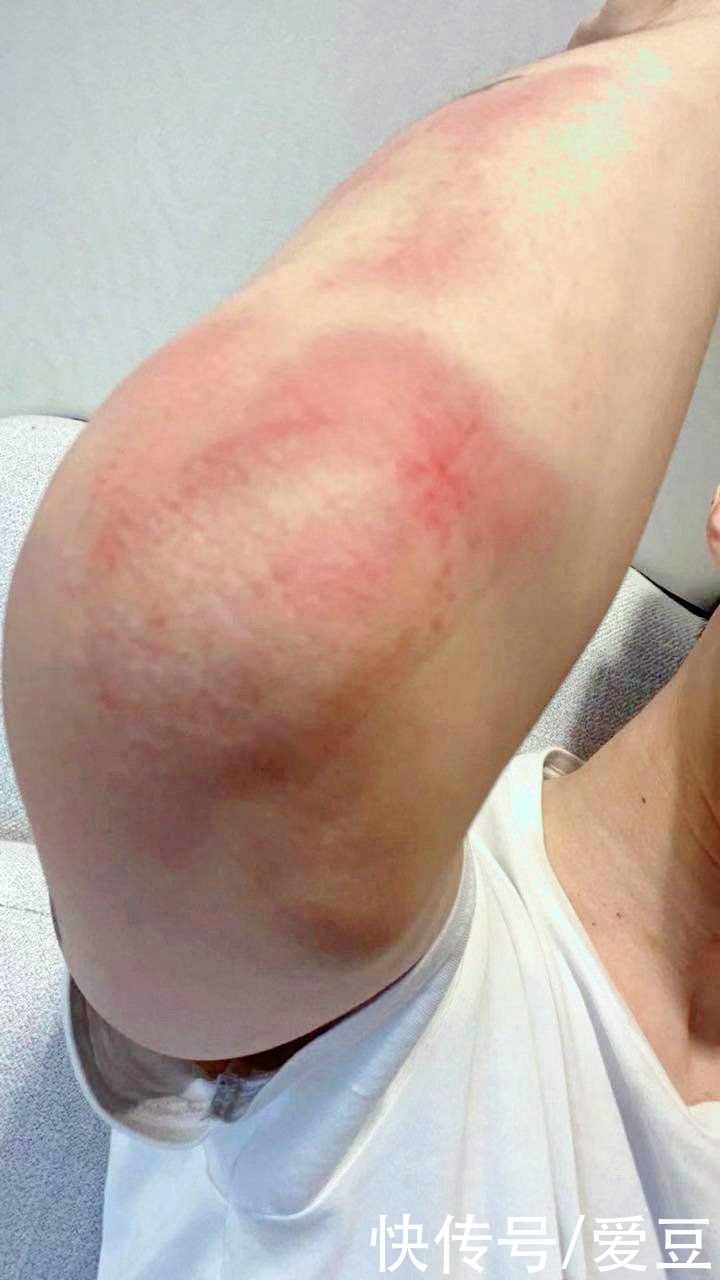 打工人|210625 打工人范丞丞久违离开剧组去录综艺 浑身是伤的小伙汁永远报喜不报忧