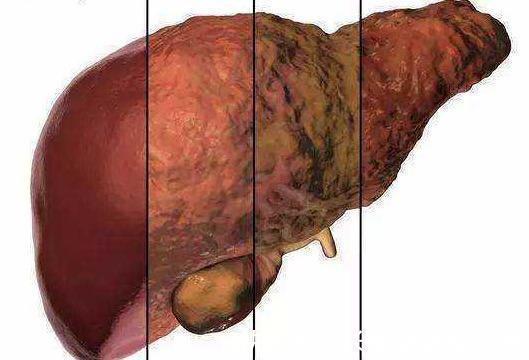 肝脏|“肝毒”太深，“脸上”有3种表现，排除肝毒，按一穴、吃三蔬