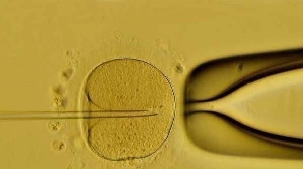 培养箱|揭秘试管婴儿全过程(附图),看完后心疼女性一万遍