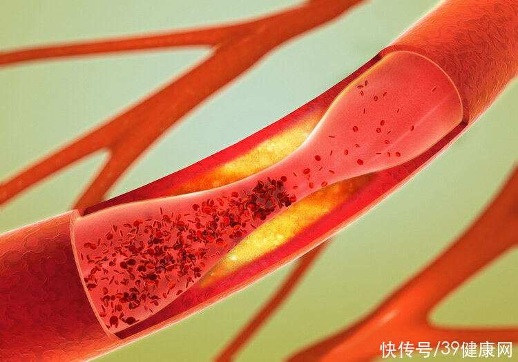 患者|他汀长期吃,有啥副作用?提醒患者:吃药一定弄明白这4件事