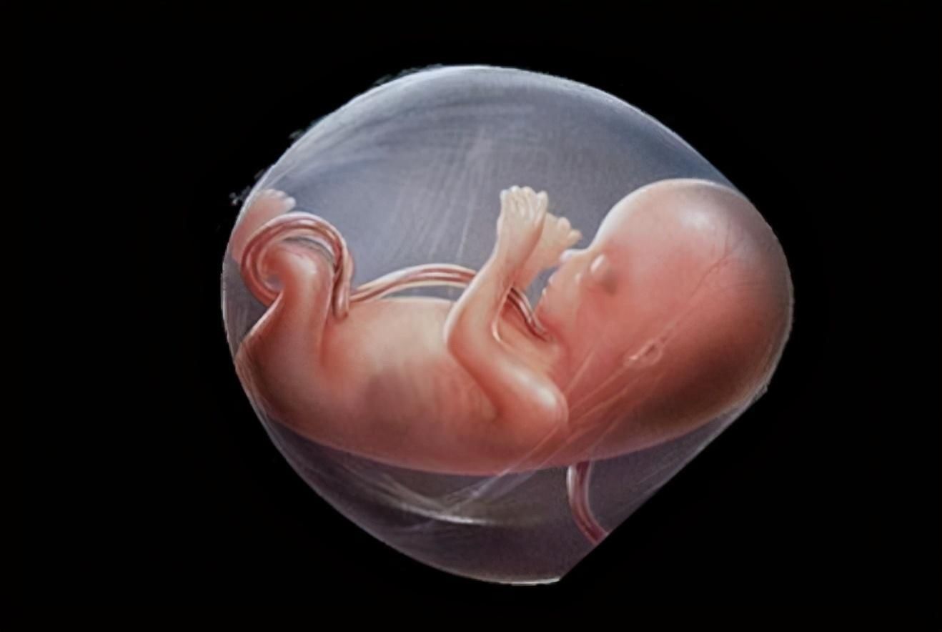 脐带绕颈|胎儿为啥总是脐带绕颈?和孕妈有一定关系,大多数妈妈都不知道