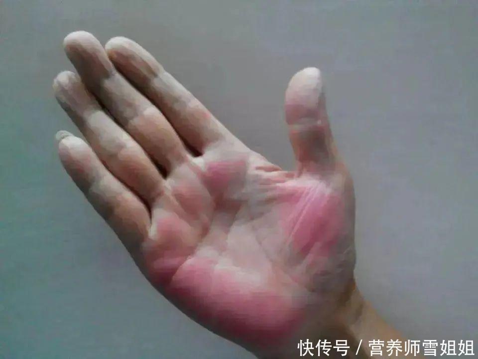 一个人肝脏好不好,看身体三个地方,冬季养肝