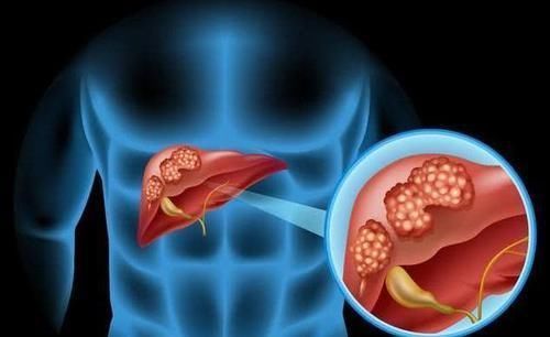 毒素|肝毒的“天敌”找到了，坚持每天吃一些，肝脏干净又健康！