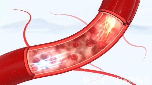 血糖|经常吃红薯,到底是升血糖还是降血糖?不妨听听医生的说法