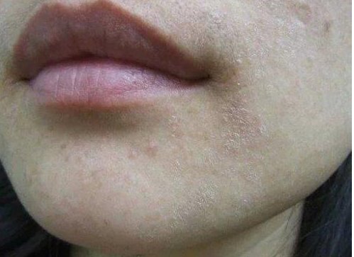 月薪3千用不起SK2、兰蔻？试试这款水乳，滋润保湿，堪比大牌水乳