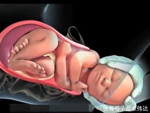 羊膜囊|顺产的全过程到底是怎样的,生而为人需了解,请勿泪奔