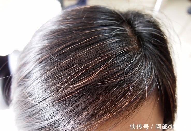 长了白发不用急这几种食物每天吃一点,还你一头黑发不是梦