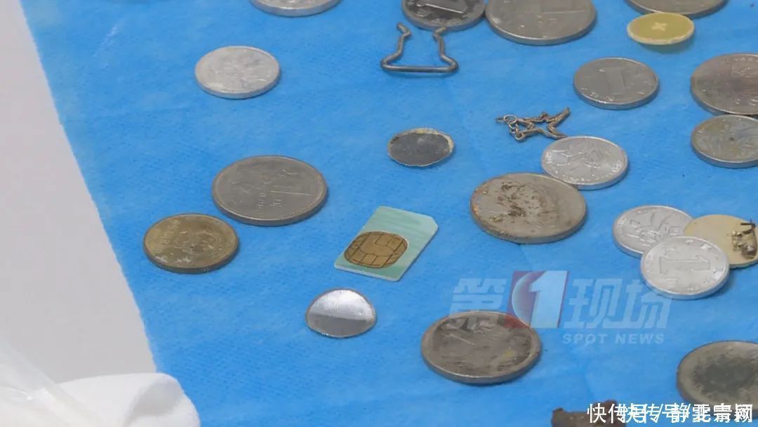 吴泽斌|家长一不留神,1岁男童食道被腐蚀!当心这些致命危险…