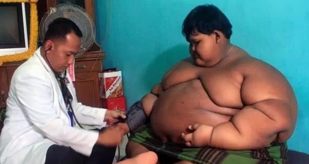 胃旁路手术|10岁男孩“体重”竟重达423榜!两年后逆袭,场面十分惊艳