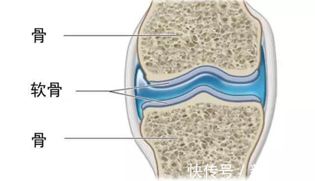 膝盖|骨科大夫这个动作最伤膝盖,你每天做的时间却超过4小时