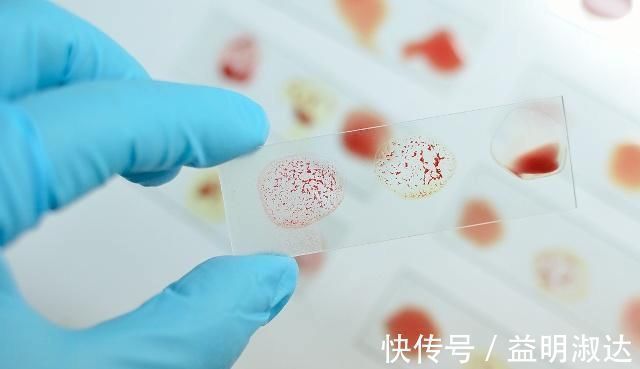 寿命|血型与寿命有关这种血型也许最“长寿”,现在知道还不算晚